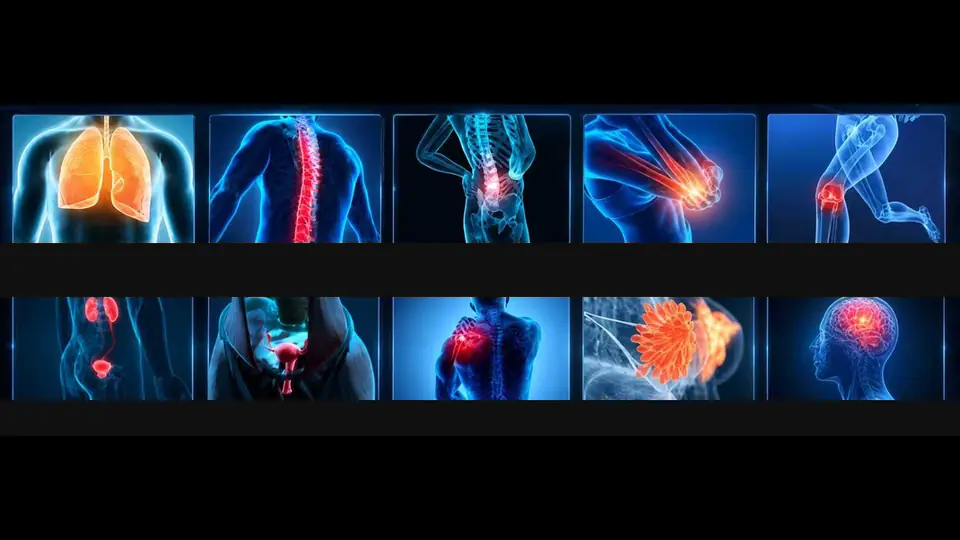 Grid of blue anatomical figures with different body areas highlighted in orange and red